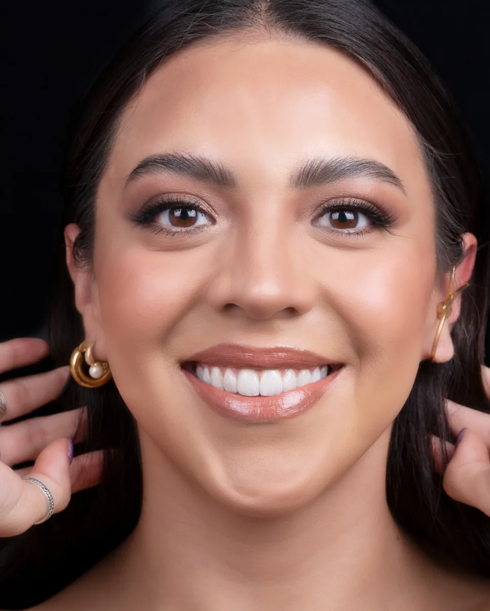 Sonrisa natural lograda con diseño de sonrisa por el Dr. Nelson Díaz Simonín en Puebla
