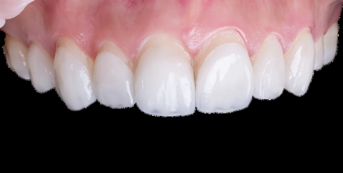 Odontología digital: escáner intraoral e impresión digital en el consultorio del Dr. Nelson Díaz